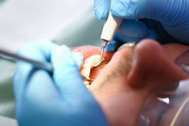 Best Emergency Dental Care for Broken or Chipped Teeth in Harker Heights, TX