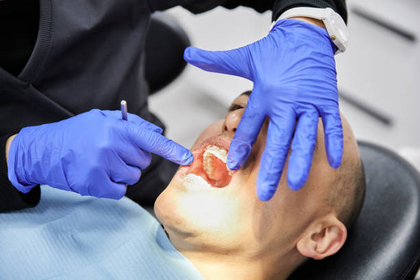 Best Emergency Tooth Extraction in Harker Heights, TX