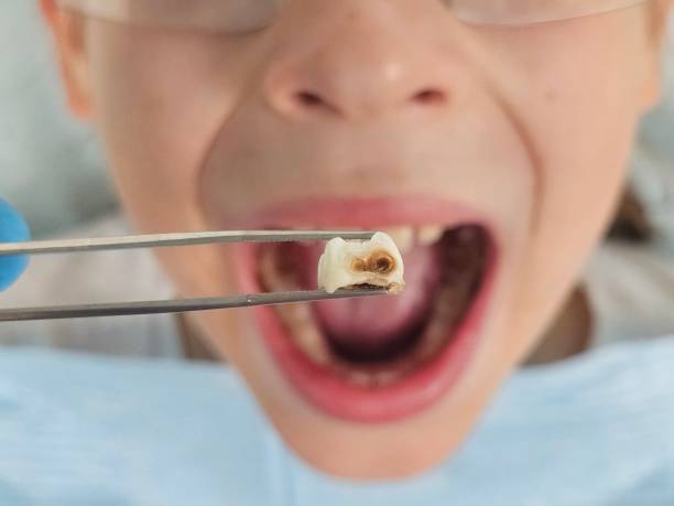 Best Emergency Dental Care for Broken or Chipped Teeth in Harker Heights, TX